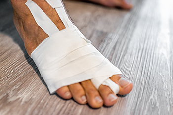 deformity correction