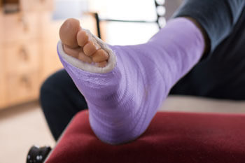 Foot Fractures treatmen in the Chandler, AZ 85248 & Phoenix, AZ 85044 areas