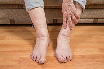 Geriatric foot care treatment in the Chandler, AZ 85248 & Phoenix, AZ 85044 areas