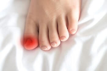 Ingrown toenails treatment in the Chandler, AZ 85248 & Phoenix, AZ 85044 areas