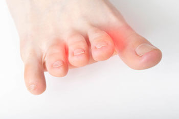 Mortons neuroma treatment in the Chandler, AZ 85248 & Phoenix, AZ 85044 areas