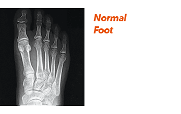 xray diagnosing in the Chandler, AZ 85248 & Phoenix, AZ 85044 areas