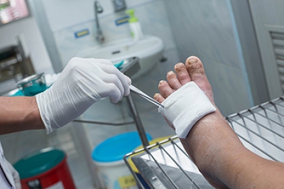 The Importance of Treatment for Diabetic Foot Ulcers
