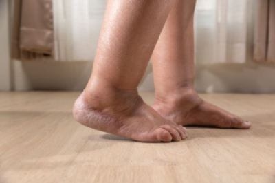 Exploring the Causes of Swollen Feet