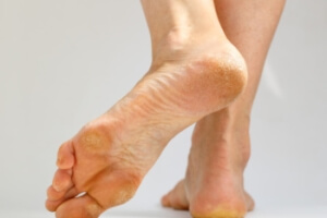 Pain in the Bottom of the Foot