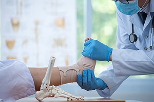 Joint Involvement in Ankle Fractures
